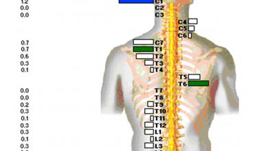 Thermodiagnostik, facharzt werne, korting orthopädie, korting osteopathie